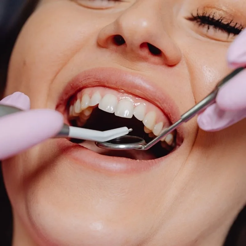 Meet the Best Dental Clinic in Ceilandia Centro (ceilandia), DF, DF, Brazil 1 4330b6f7d7764d2e9b24795c06e2f848